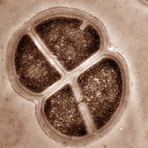 Род Deinococcus-thermus фото