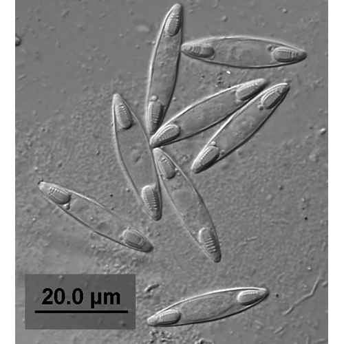 Тип Myxozoa фото