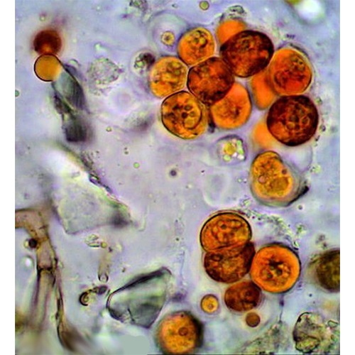 Класс Роделлофициевые водоросли фото